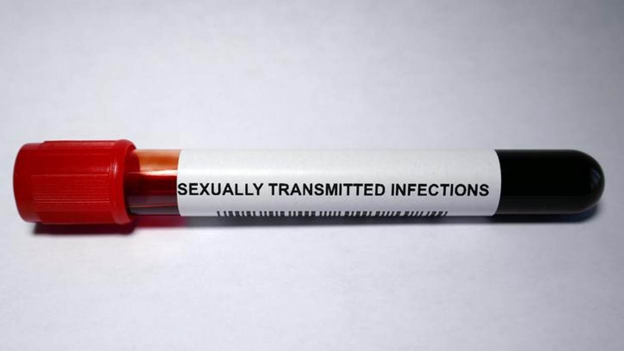 6 STIs You Need to Know About