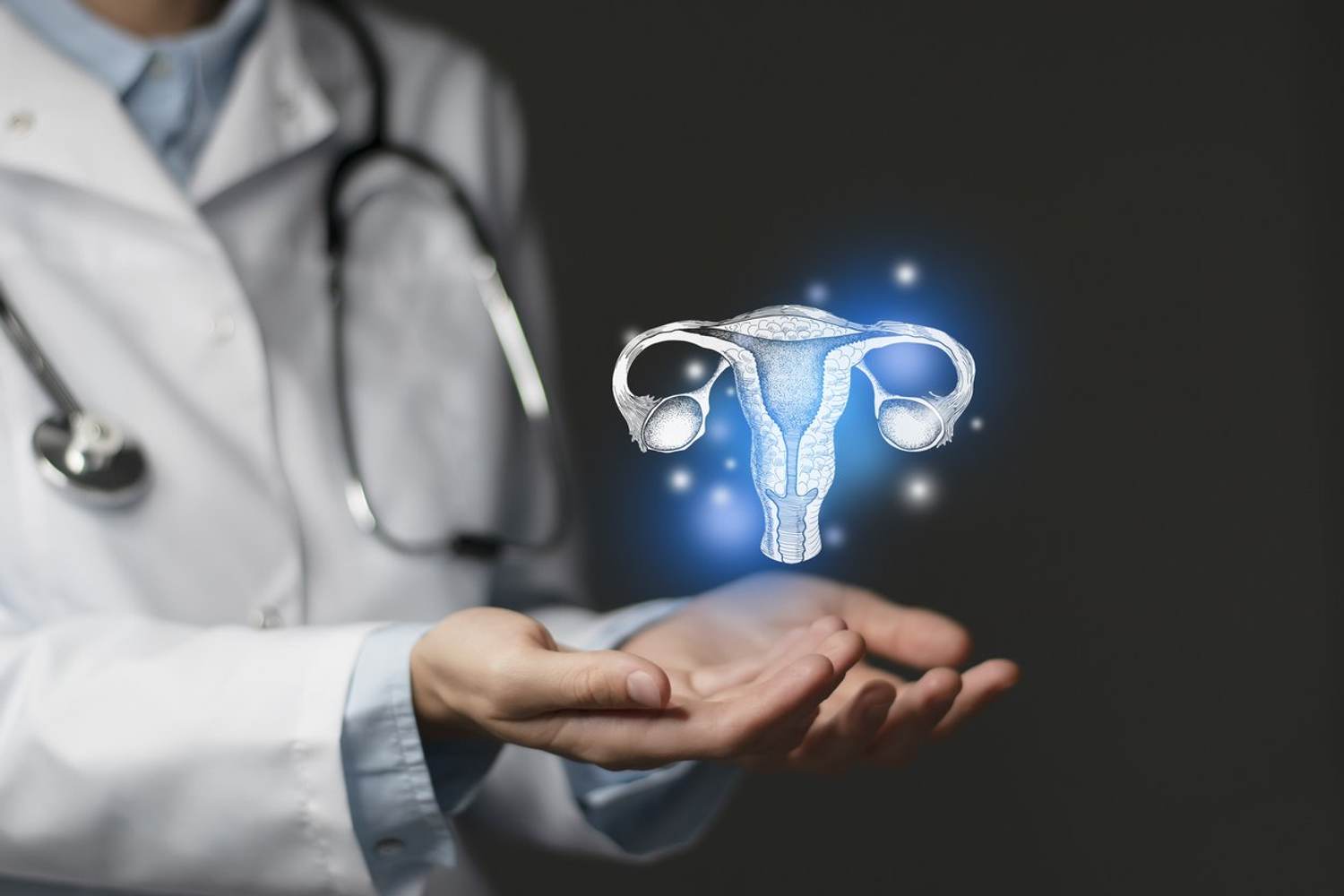 Ovarian Remnant Syndrome