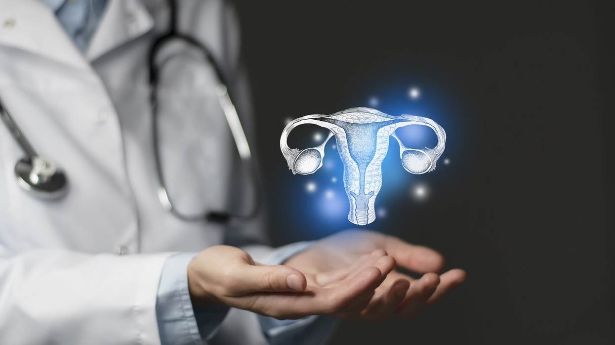 Ovarian Remnant Syndrome