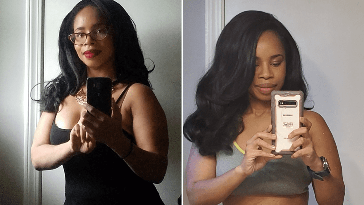 After My Hysterectomy, I’m Living My Best Life