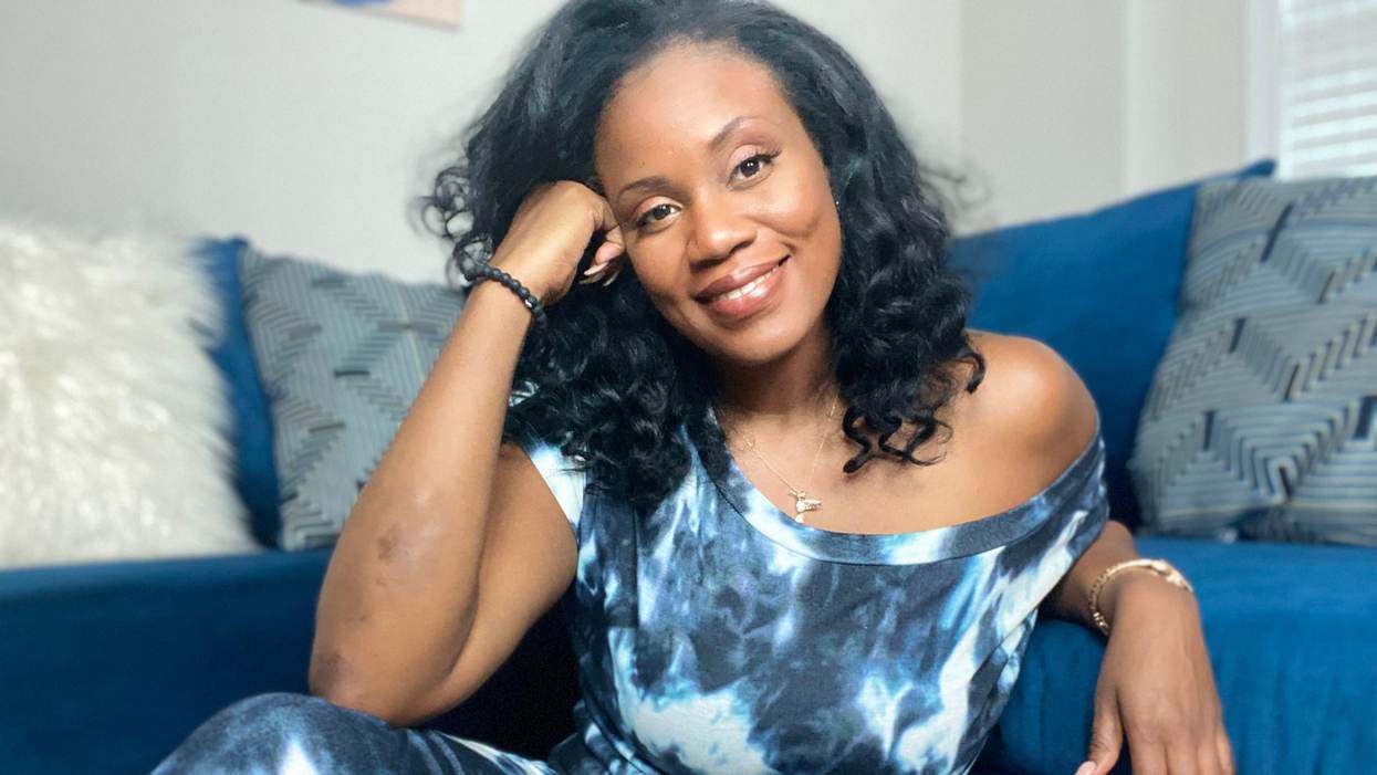My Psoriasis Led to My Empowerment