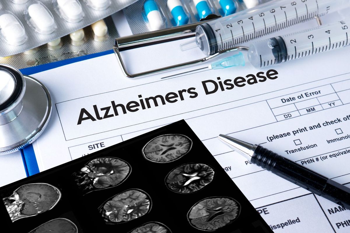 Alzheimers Disease concept