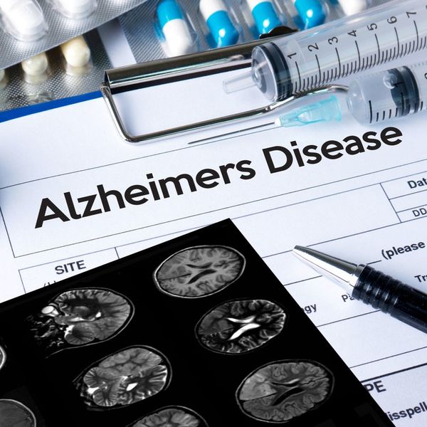 Alzheimers Disease concept