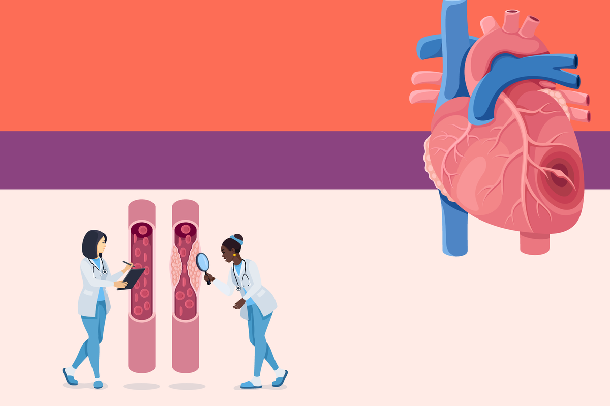 Are You at Risk for Heart Disease?