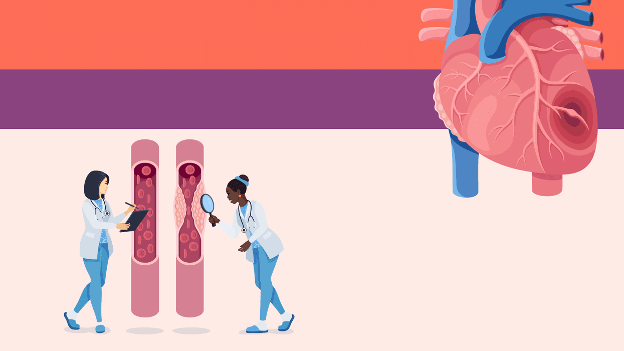 Are You at Risk for Heart Disease?
