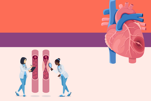 Are You at Risk for Heart Disease?