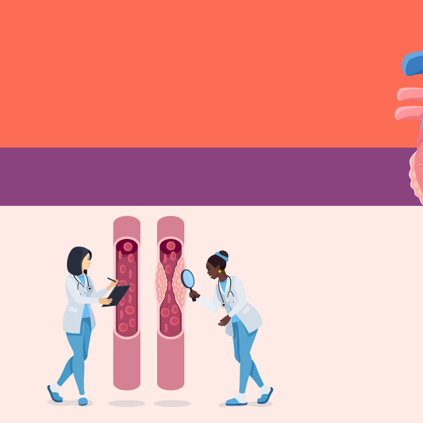 Are You at Risk for Heart Disease?