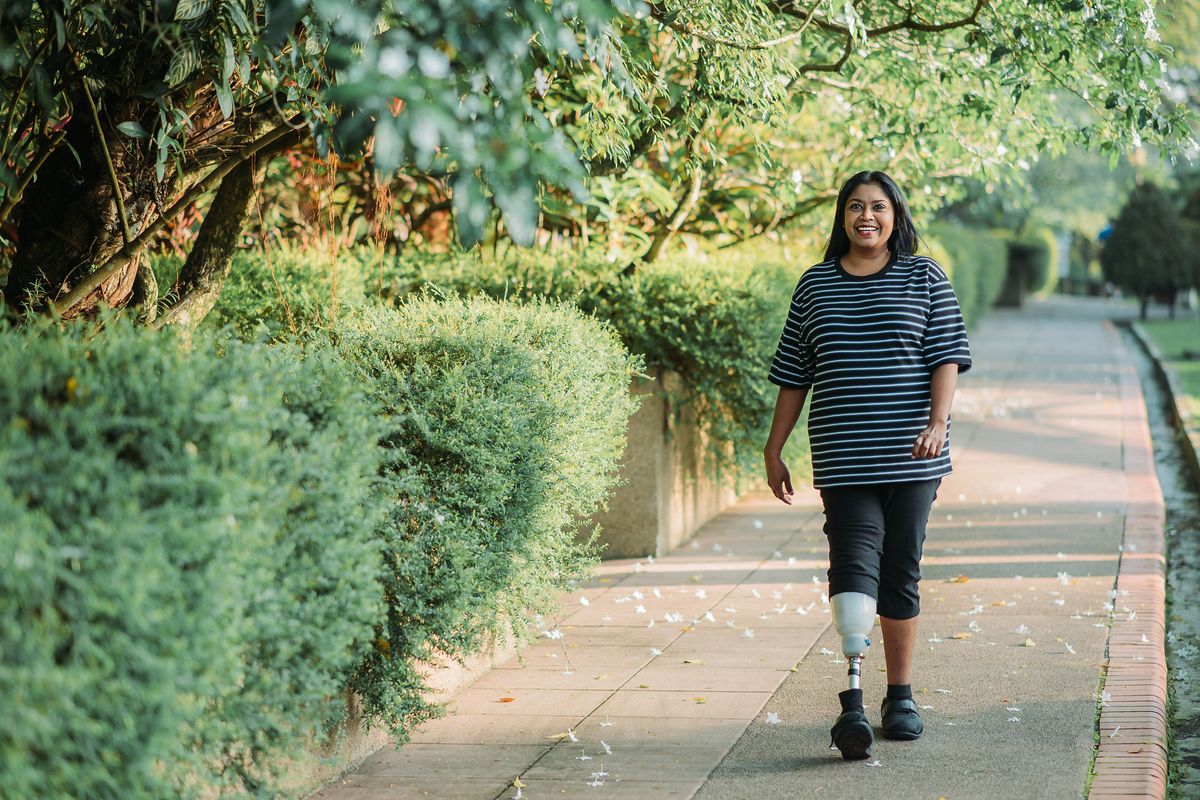 Asian Indian handicapped with prosthetic leg smiling woman