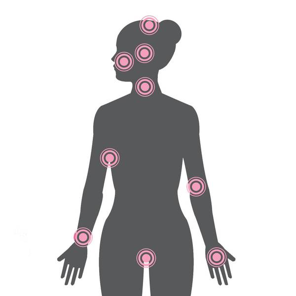 Atopic Dermatitis Across Your Body