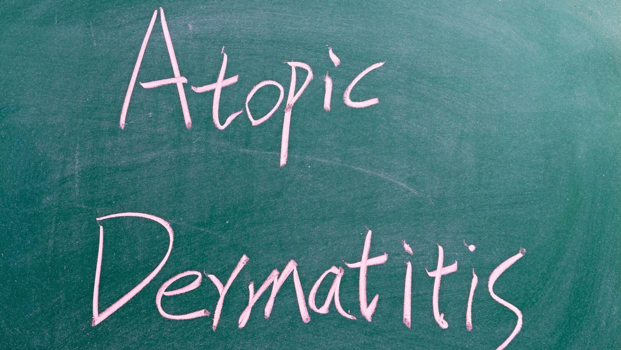 Living With Atopic Dermatitis (AD)