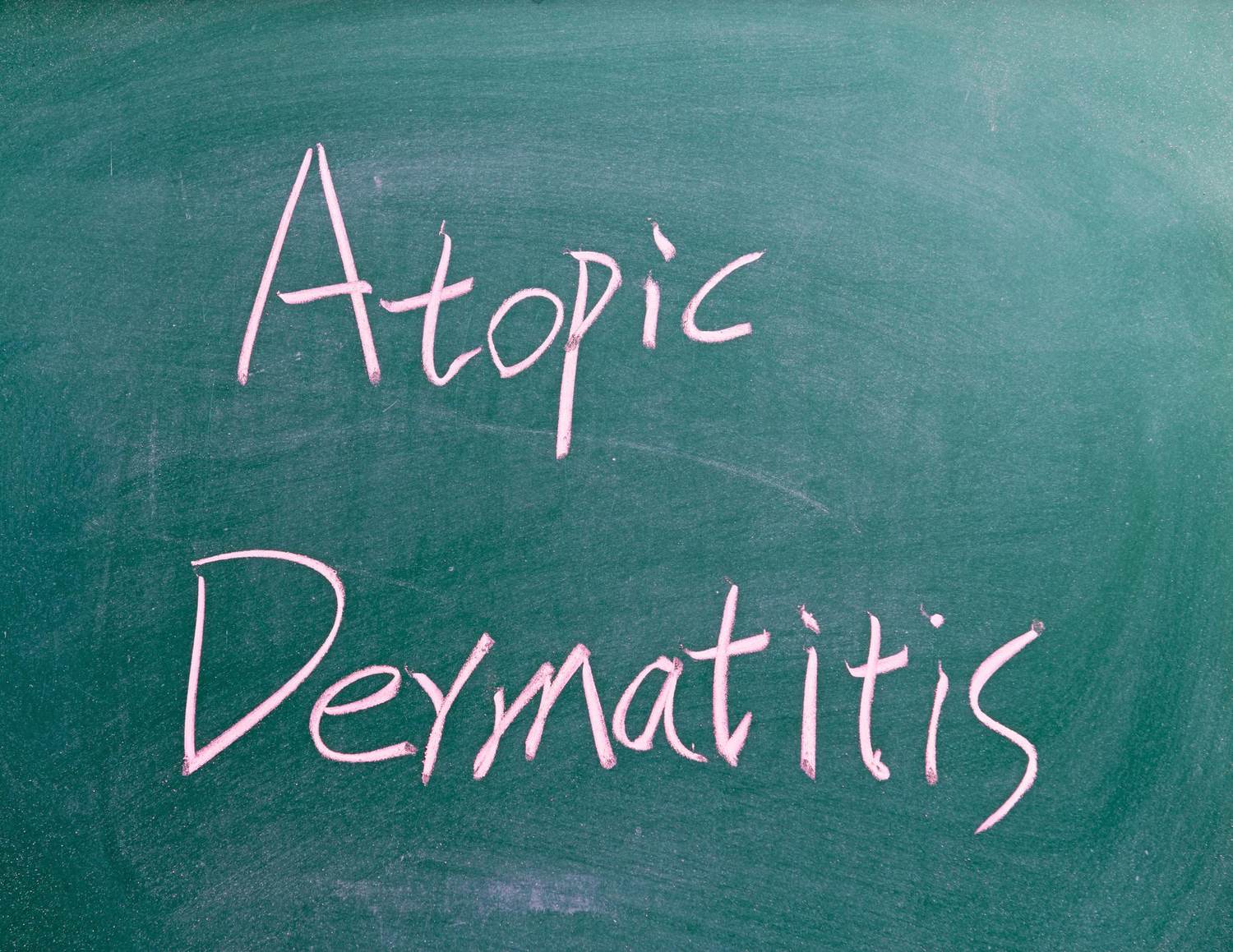 Living With Atopic Dermatitis (AD)