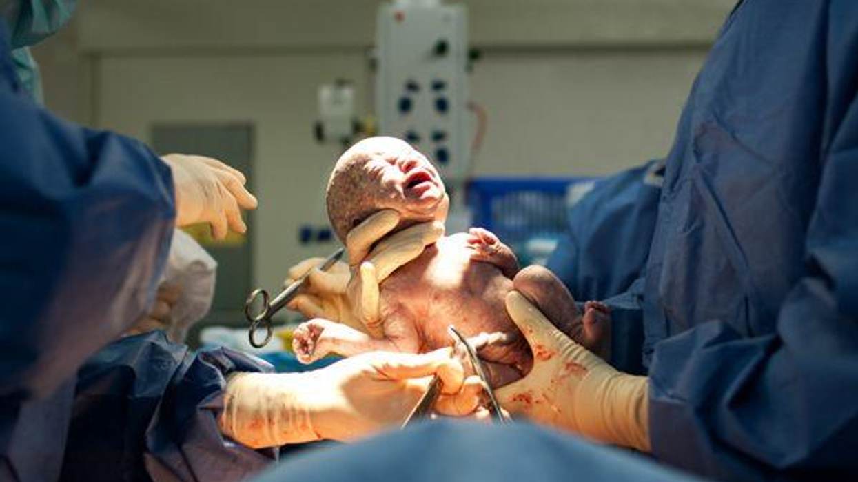 The Gentle Cesarean: More Like a Birth Than an Operation
