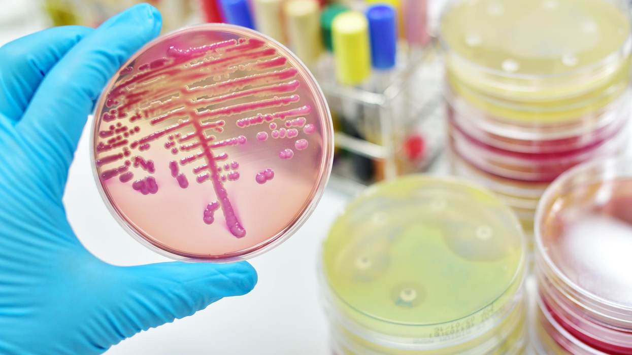 Antibiotic Resistance Is at a Crisis Point – Government Support for Academia and Big Pharma to Find New Drugs Could Help Defeat Superbugs