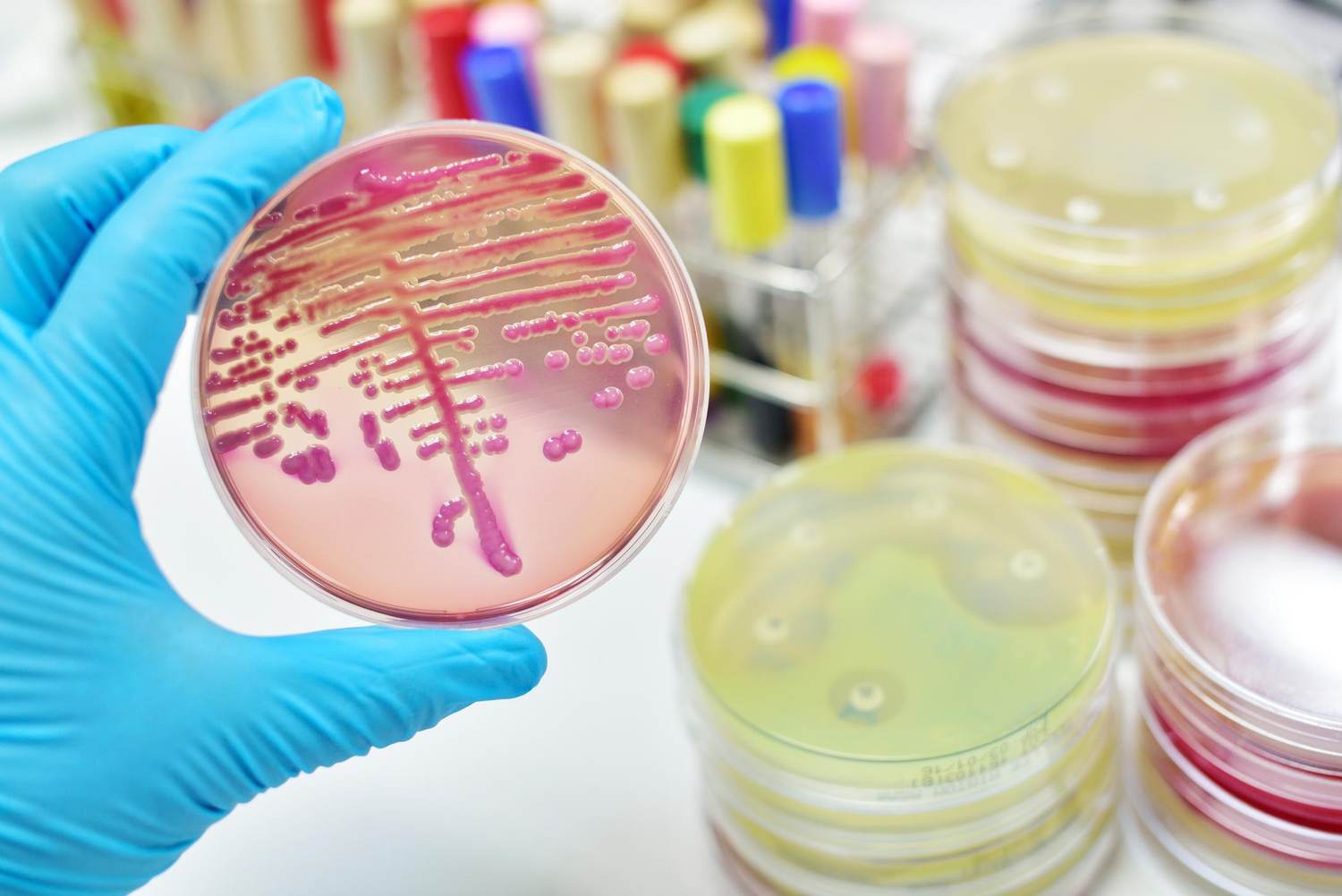 Antibiotic Resistance Is at a Crisis Point – Government Support for Academia and Big Pharma to Find New Drugs Could Help Defeat Superbugs