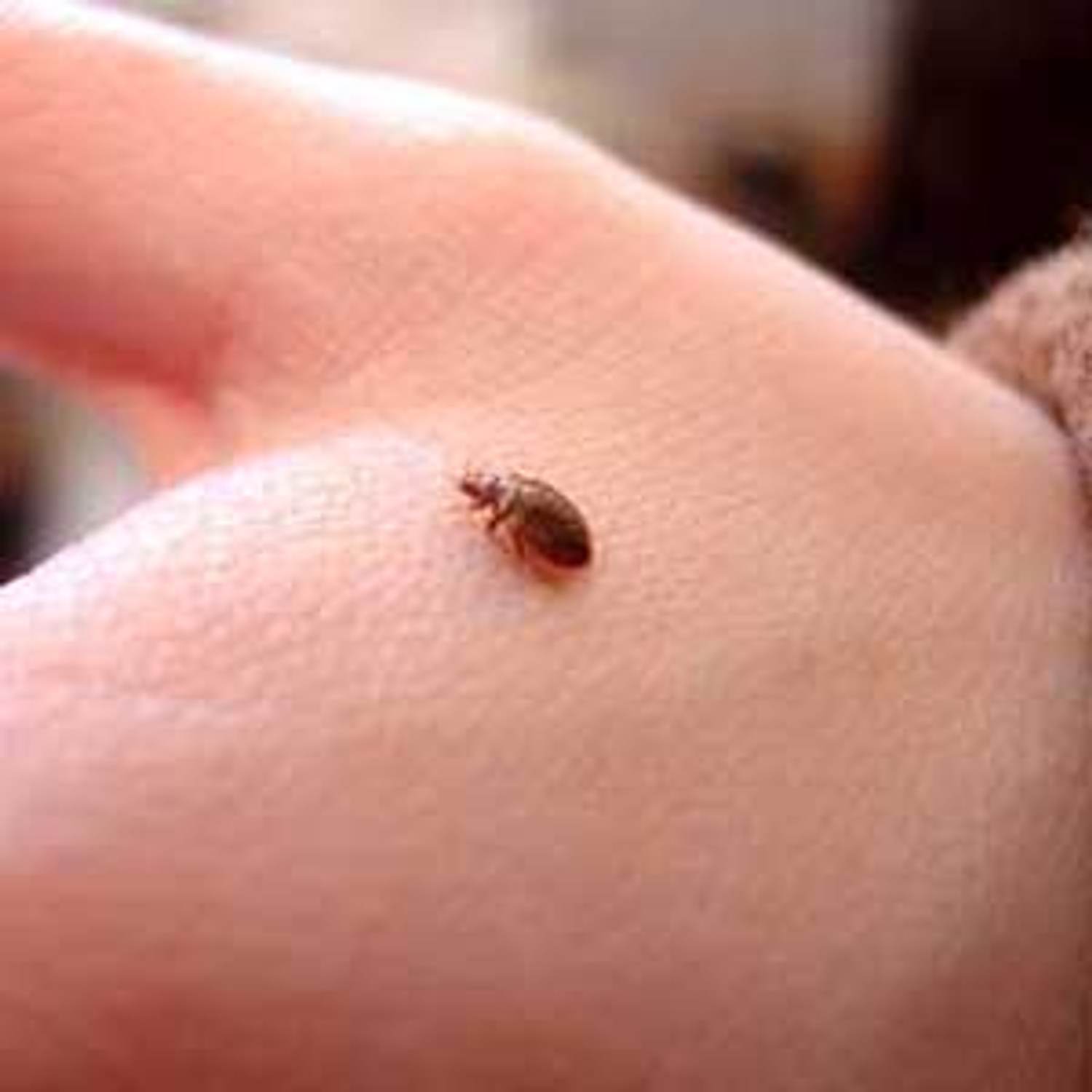 Bedbugs Stage a Comeback