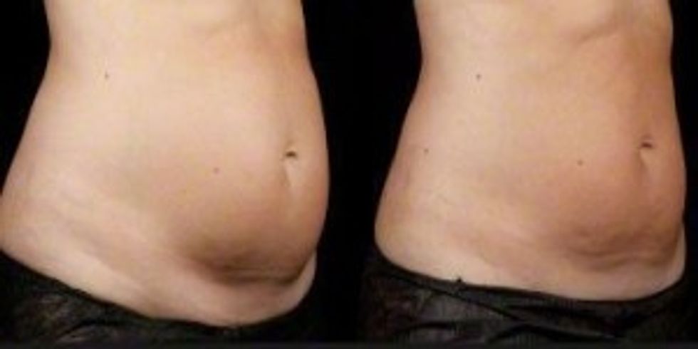 before and after photo