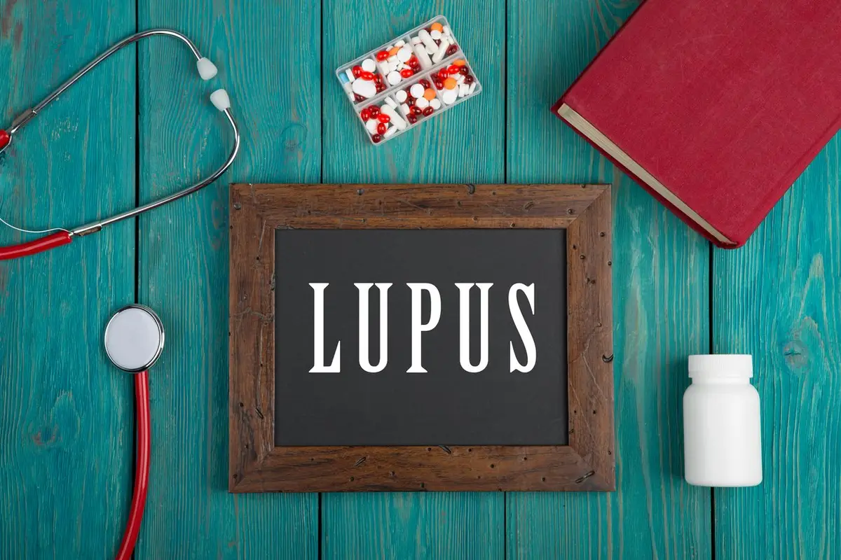 Blackboard with text "Lupus"