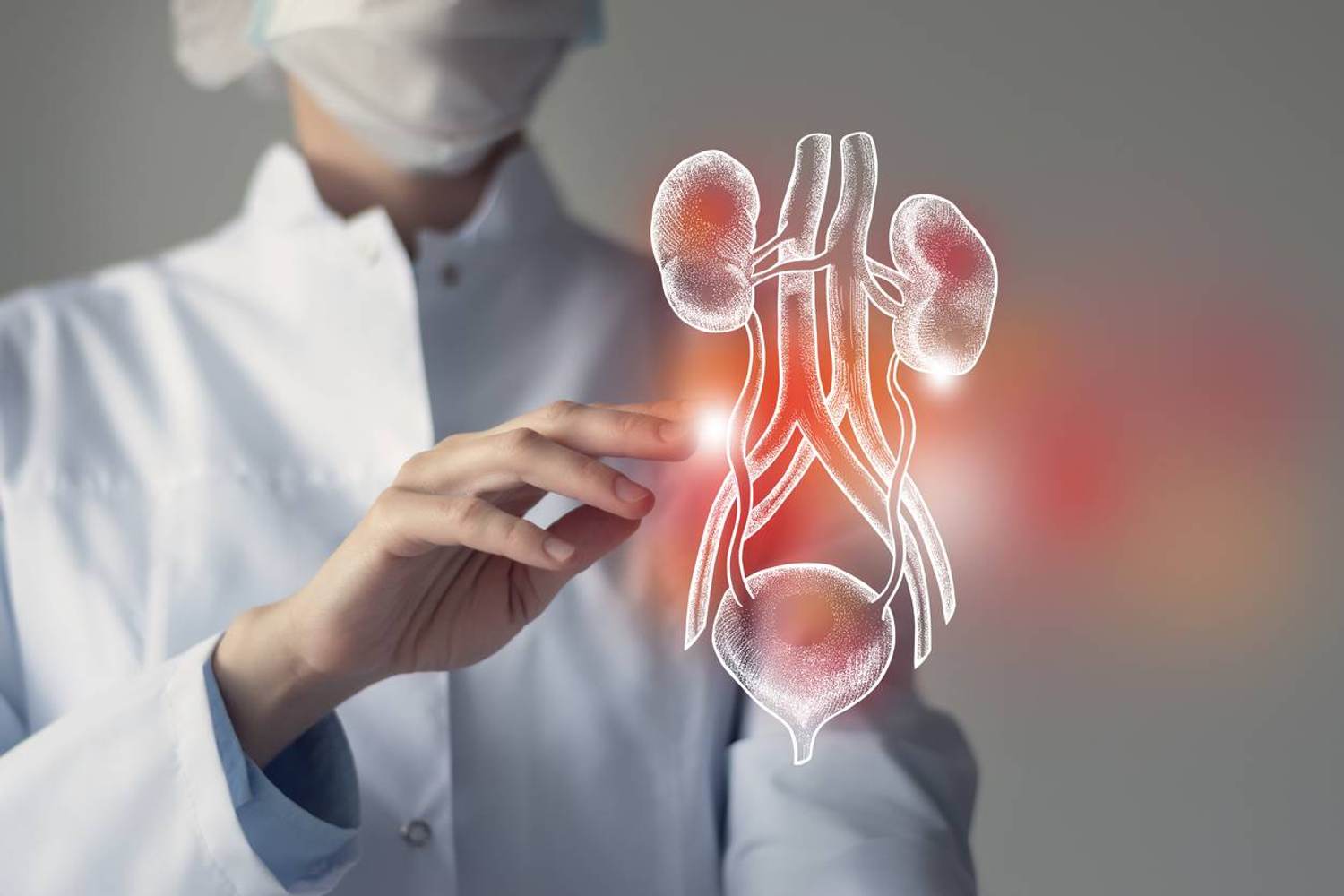What Is Primary Hyperoxaluria?