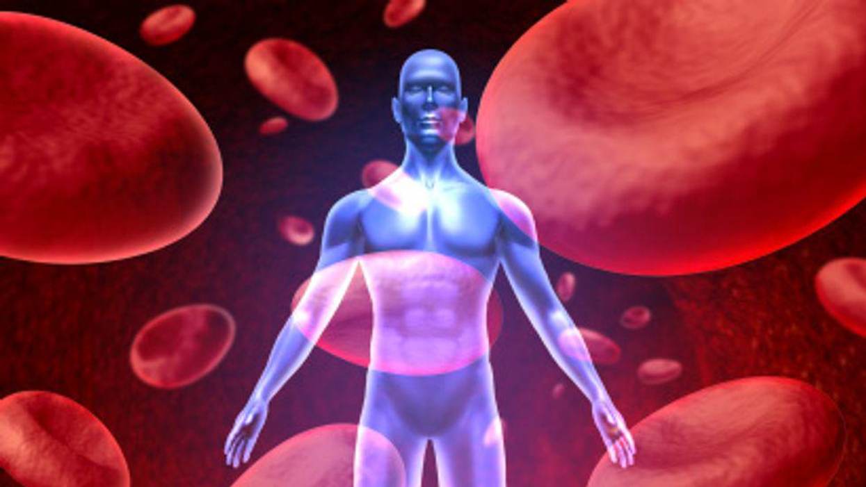 Hidden Threat: Deep Vein Thrombosis