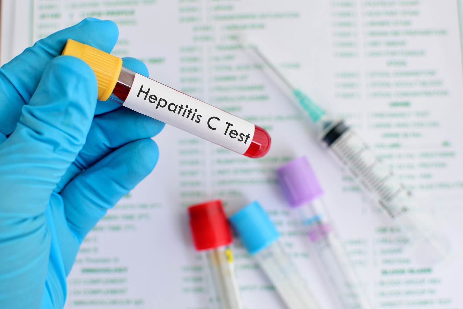 Hepatitis C and Baby Boomers