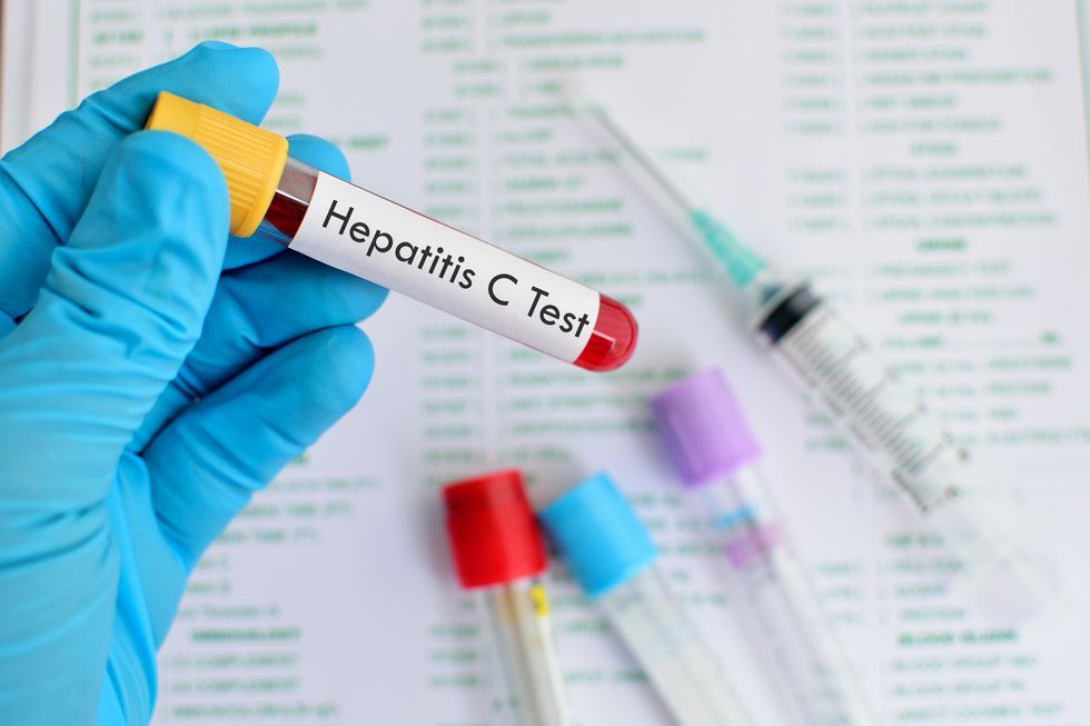 Blood sample for hepatitis C virus testing