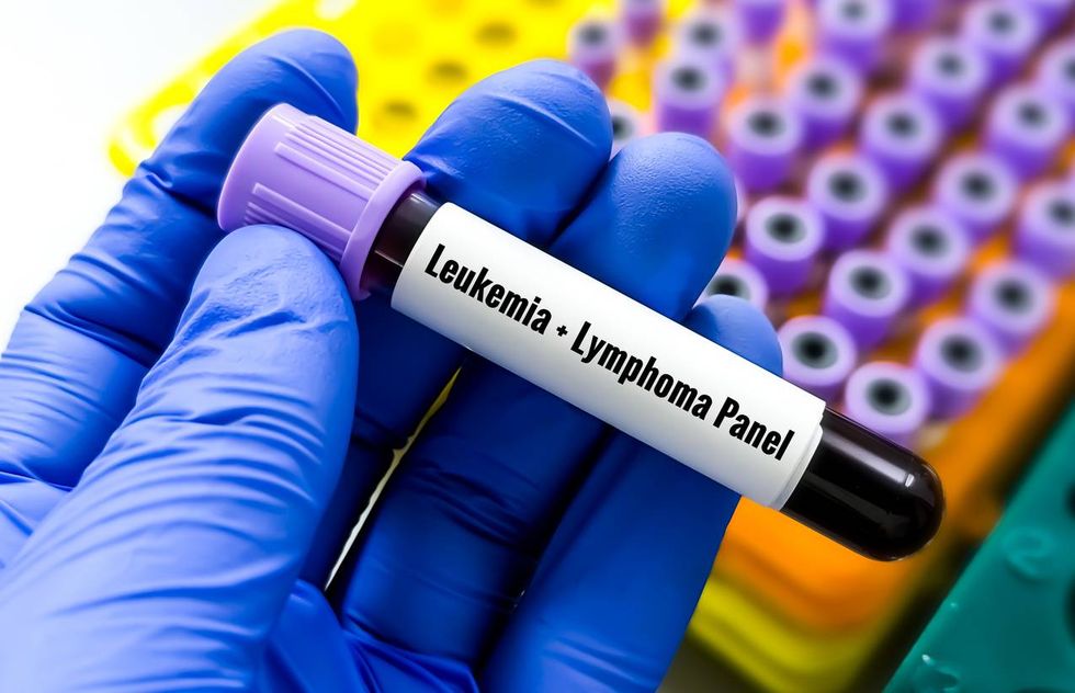 Blood sample for Leukemia and Lymphoma panel test