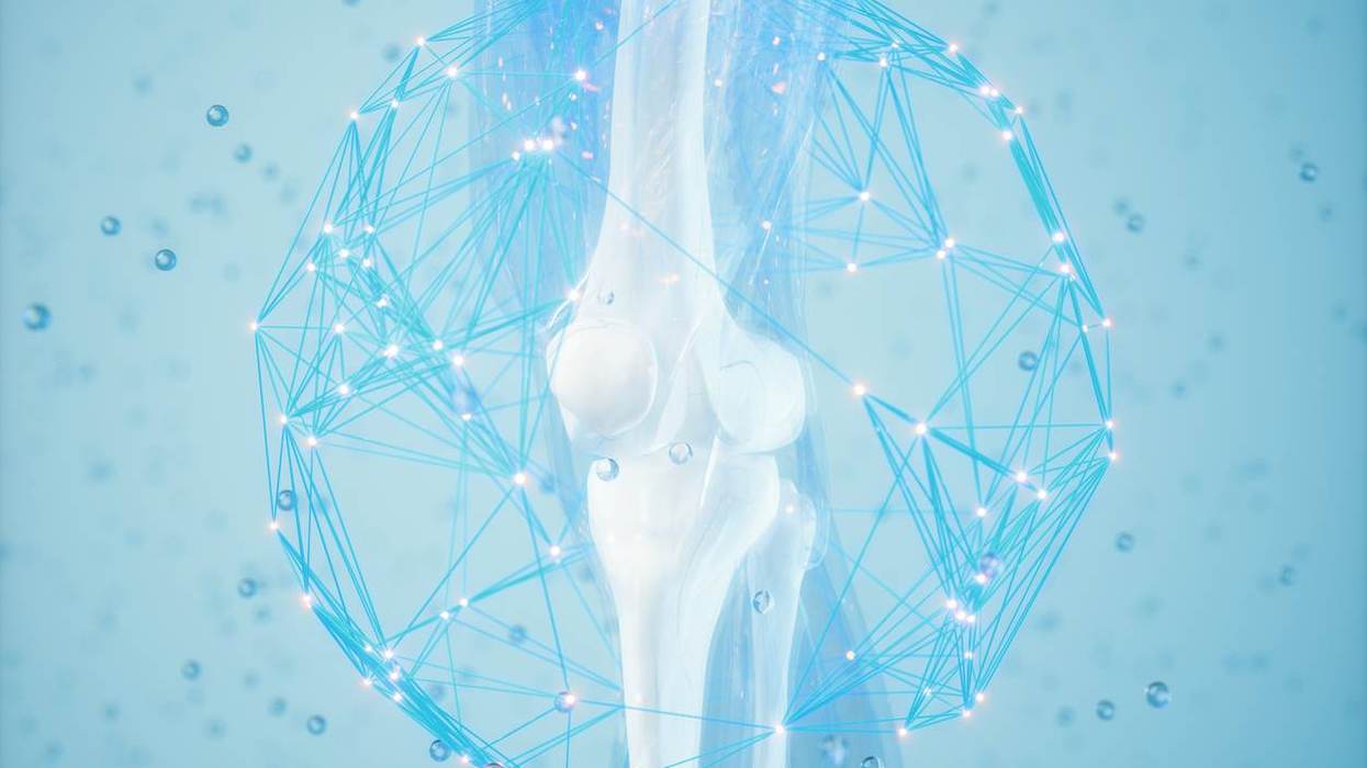 Tech Is Reinventing How We Detect and Treat Osteoporosis and Osteopenia