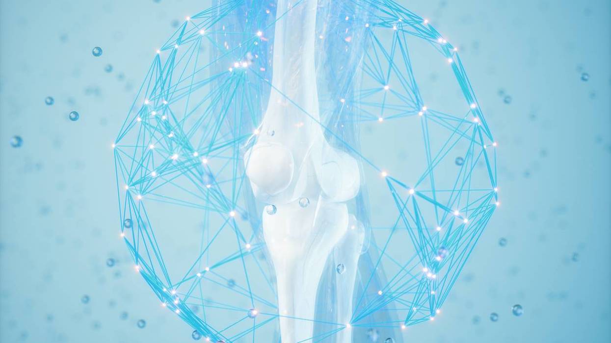bone with osteoporosis