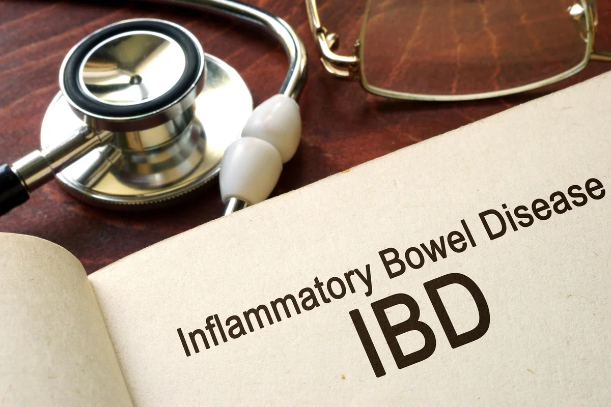 Book with words inflammatory bowel disease IBD on a table