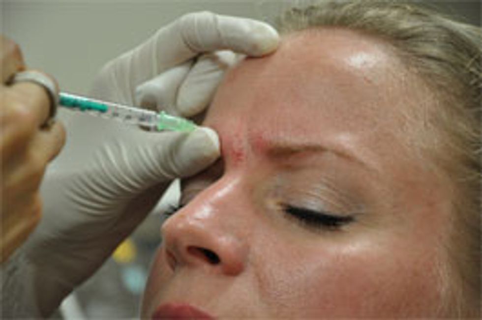 botox cosmetic procedure - katarina close-up injection