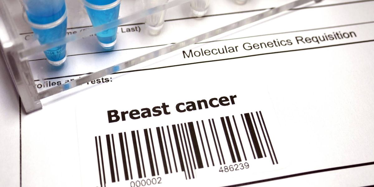 What Is a Breast Cancer Index Test?