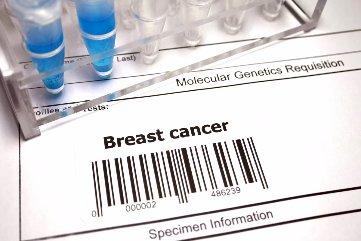 Breast cancer test result sheet