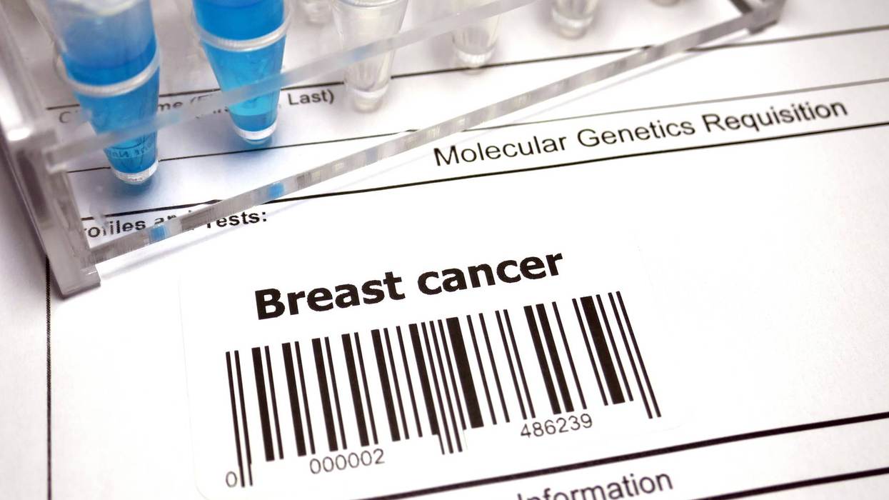 What Is a Breast Cancer Index Test?