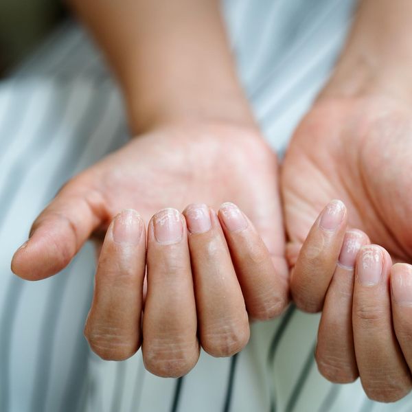 brittle damaged nails after using shellac or gel-lacquer