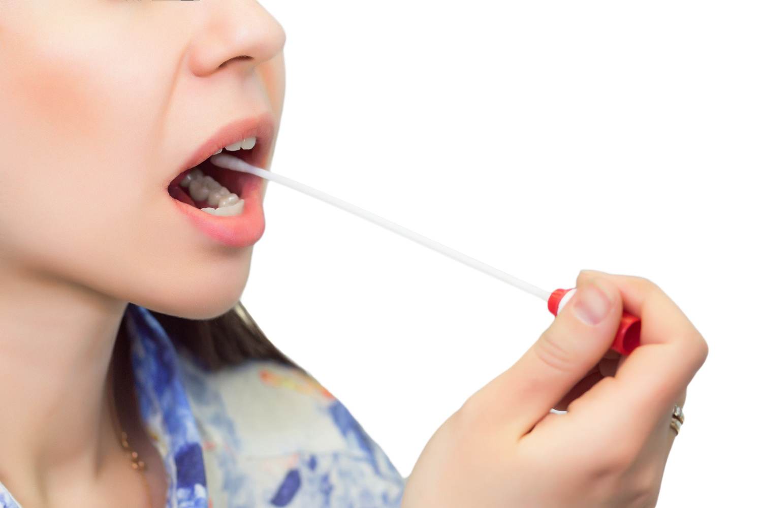 Can Insurers Use Genetic Testing Results?