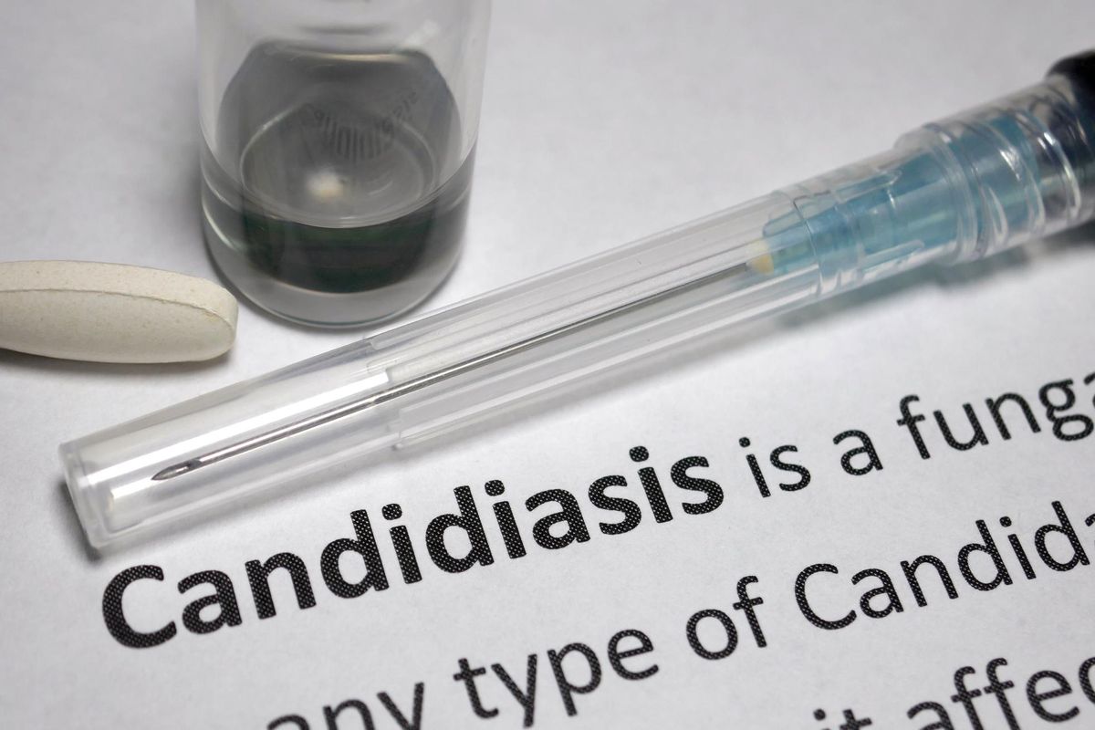 Candidiasis stock photo