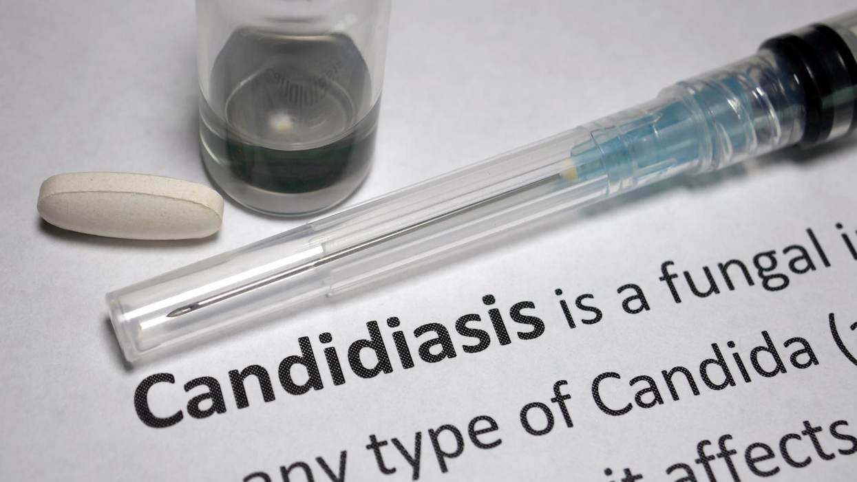 Fast Facts: What You Need to Know About Recurrent Vulvovaginal Candidiasis (Chronic Yeast Infection)