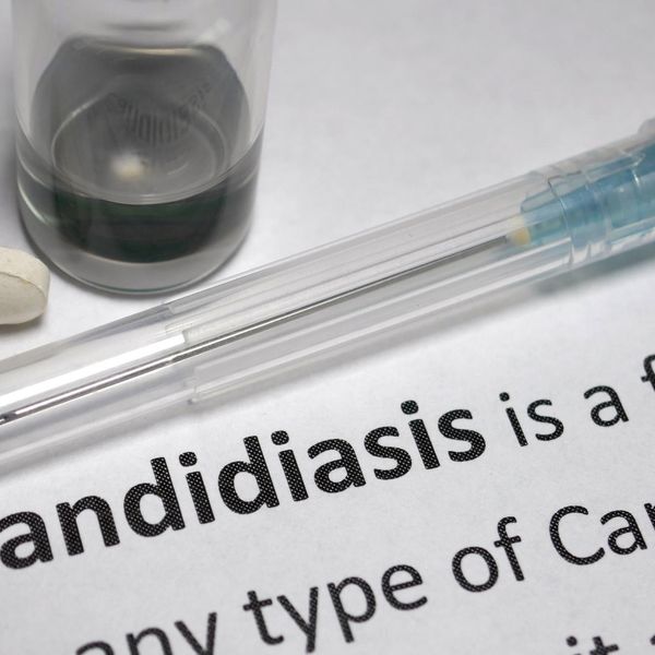 Candidiasis stock photo