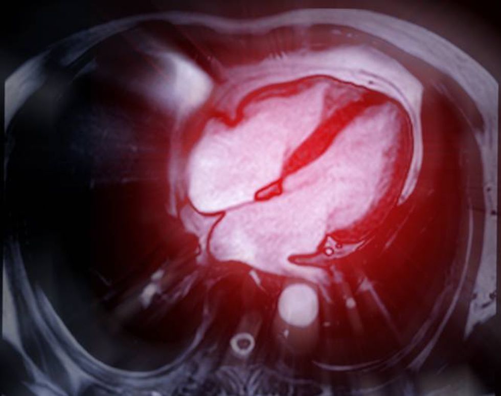Cardiac MRI images