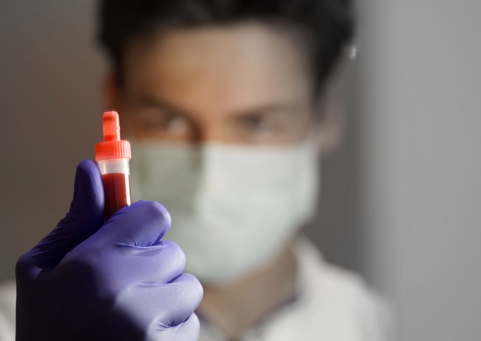 Checking Blood for Coronavirus Antibodies – 3 Questions Answered About Serological Tests and Immunity