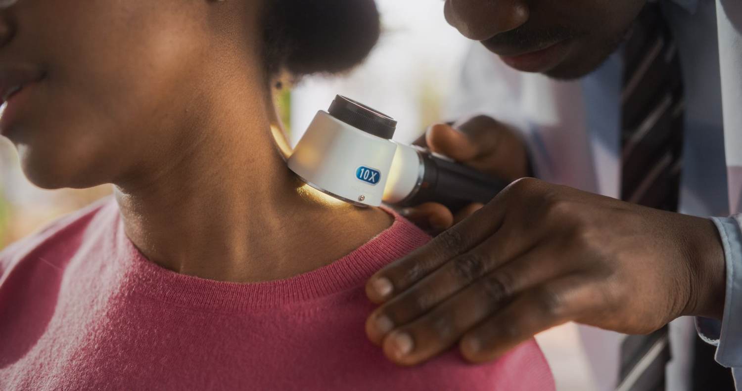 Melanoma Rates Are Rising. How Can You Protect Yourself?