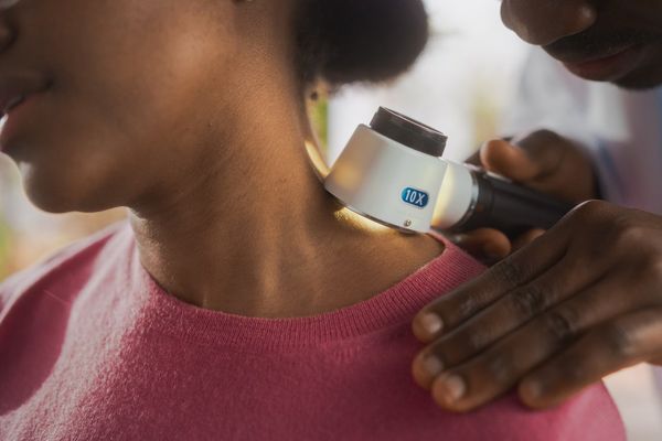 Close Up of a Black Dermatologist Using a Medical Magnifying Glass to Inspect any Damages on the Skin of a Female African Patient
