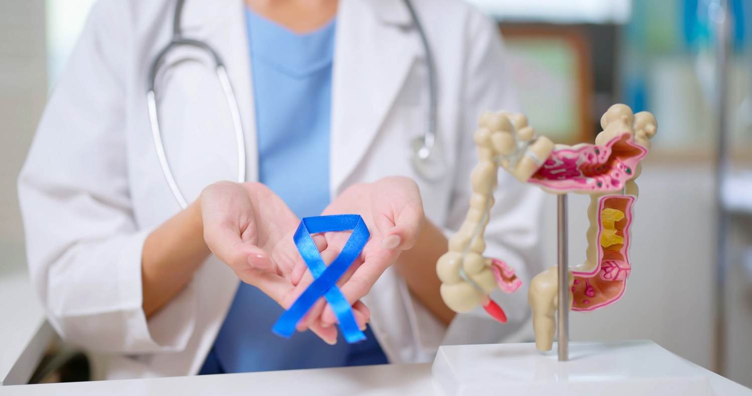 Cáncer colorrectal 101