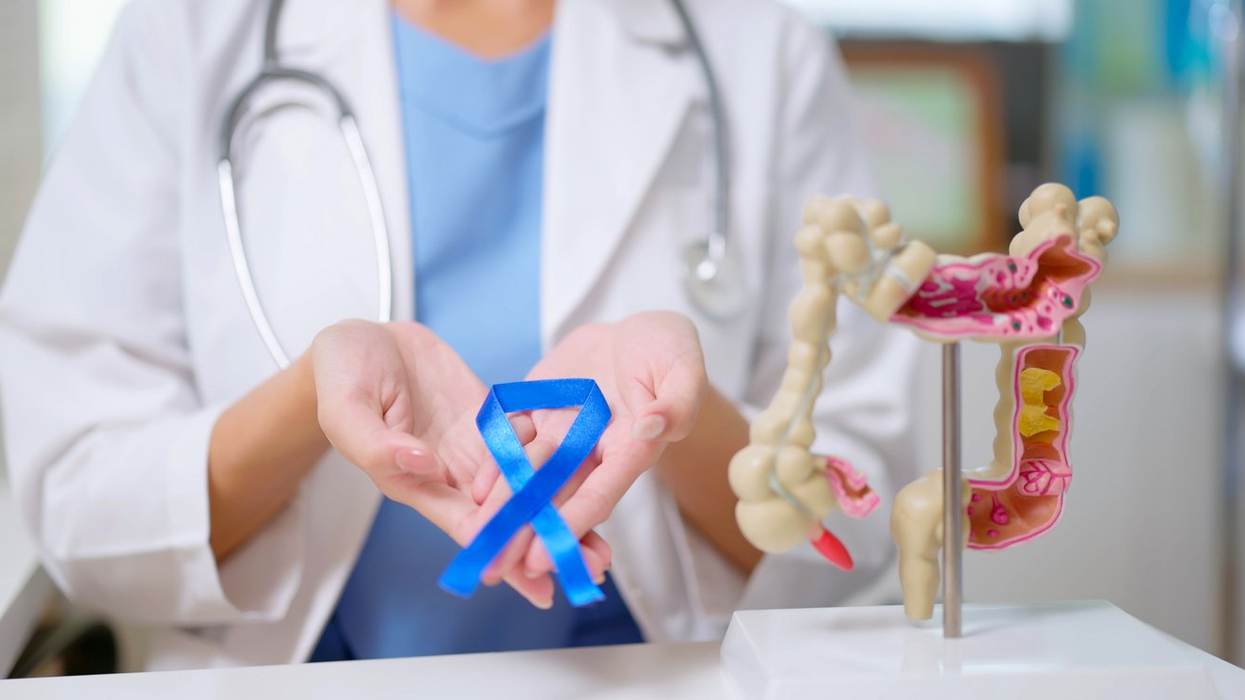 Colon Cancer 101