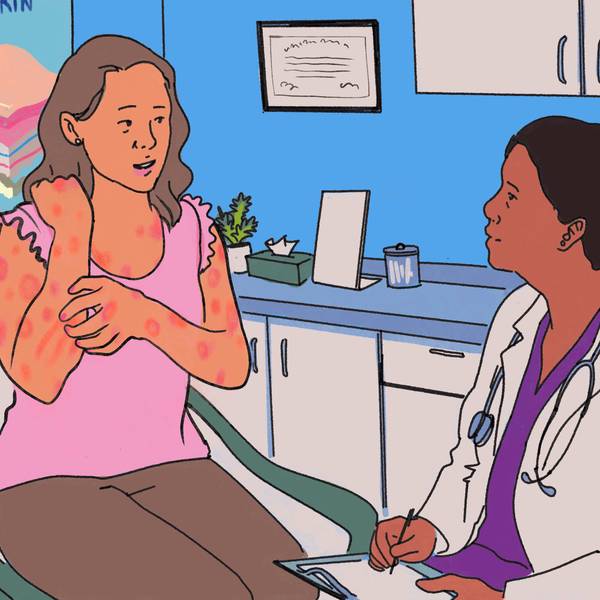 Comic: Holly’s Hives Won’t Go Away