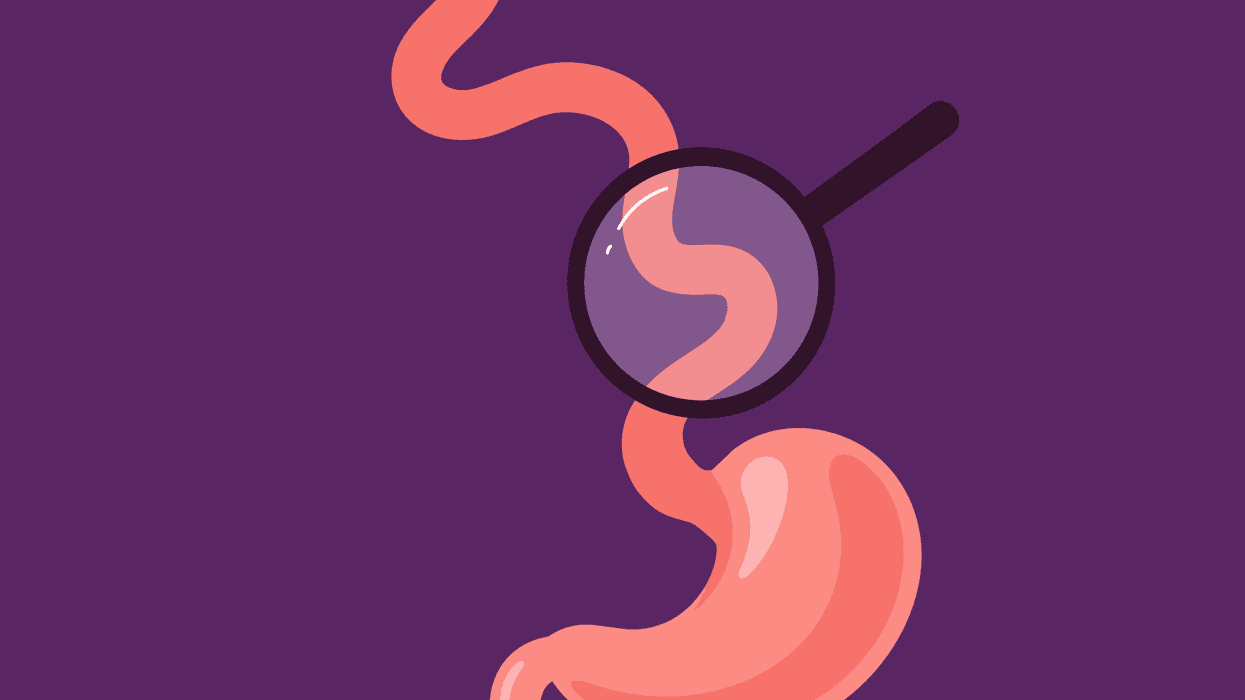 Comprende y controla la esofagitis eosinofílica (EEo) infographic