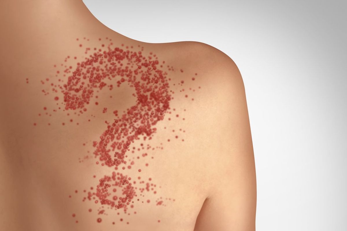 contagious chickenpox or a skin rash