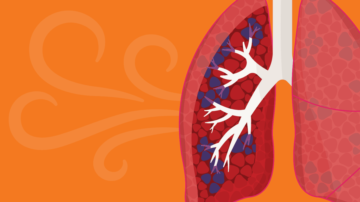 Effective COPD Treatments: A Comprehensive Guide