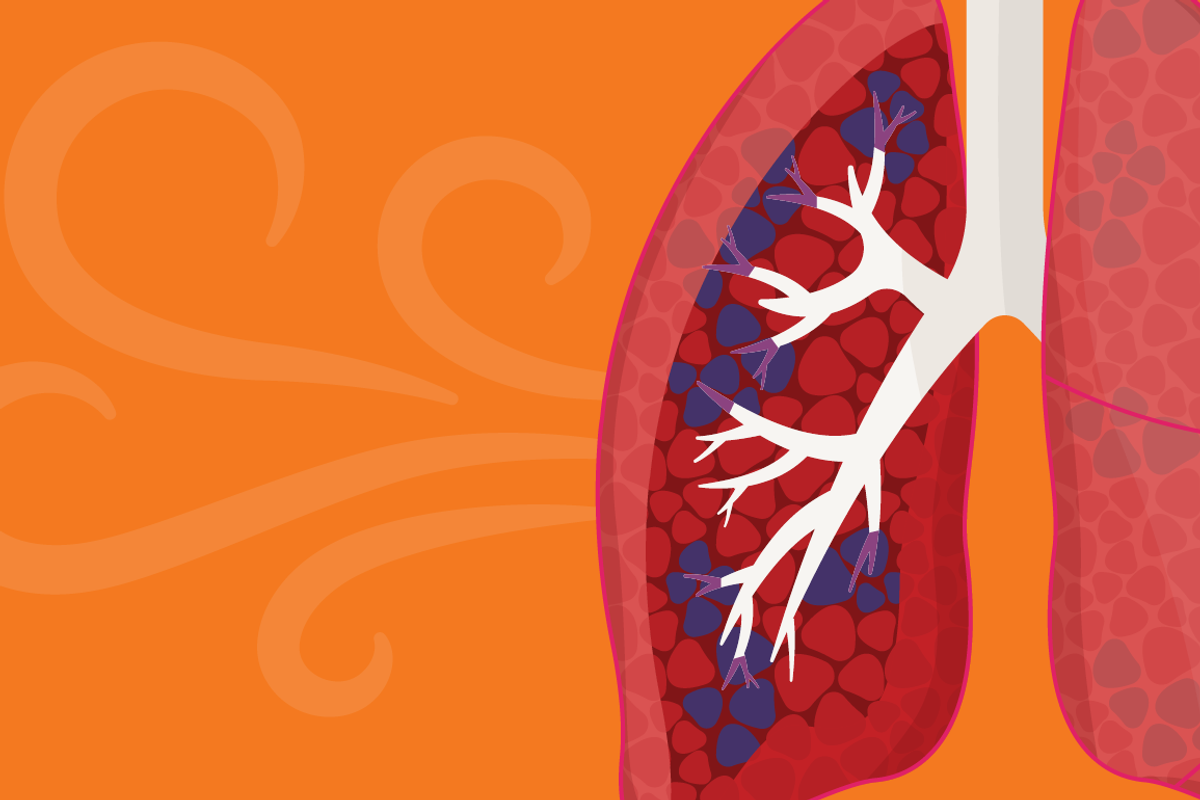 COPD Treatments infographic