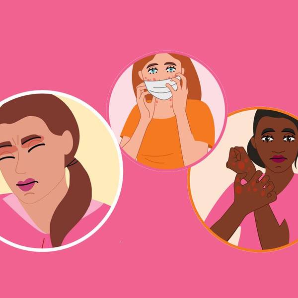 Coping With Atopic Dermatitis